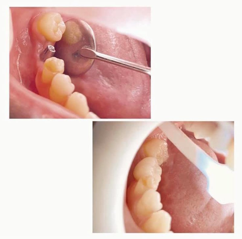 Medisante - Clinica dentara