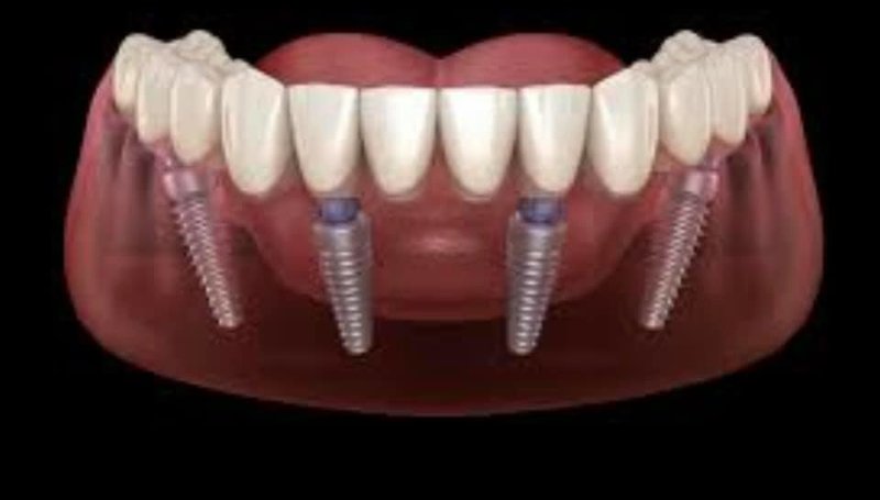 Medisante - Clinica dentara