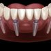 Medisante - Clinica dentara